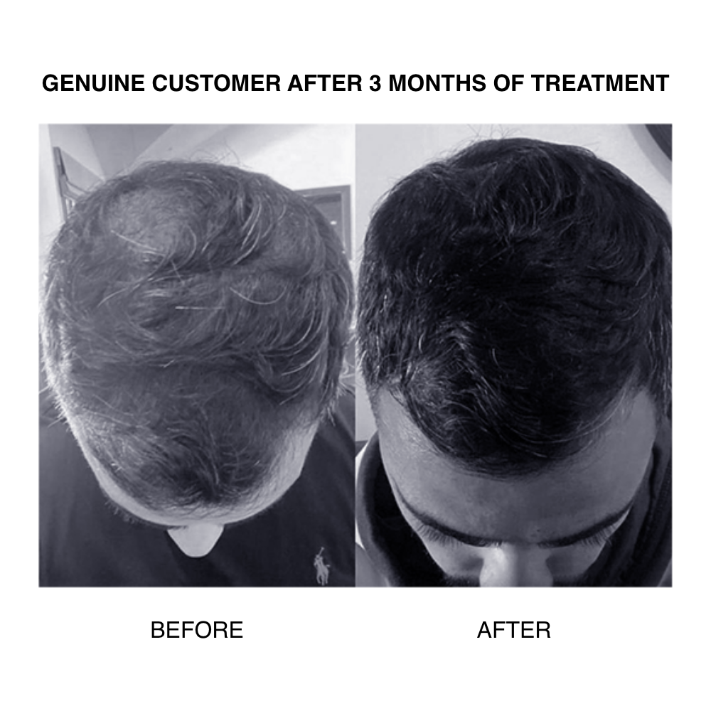CD PLUS | ULTRA THICKENING ANTI HAIRLOSS CONDITIONER 200ML